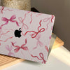 Bow Bliss | Macbook Case